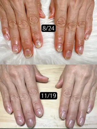 ネイル 高島 夏海のネイルデザイン