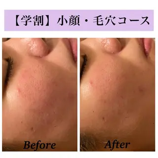 Bellesthe （ベルエステ）のエステ・リラクイメージ