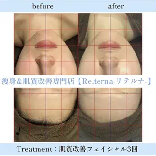 肌質改善専門店 Re.terna田辺のエステ・リラクイメージ