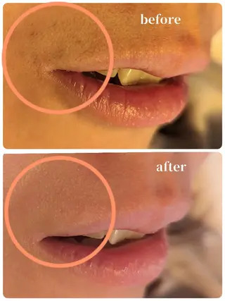 venusbeautysalon所属・eye&beauty /オーナー古田琴のエステ・リラクイメージ