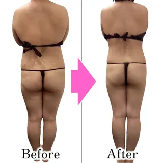 ダイエットラボ梅田店 🌟のエステ・リラクイメージ