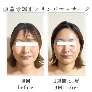 Mignon Lulu🎀のエステ・リラクイメージ