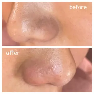 肌質改善エステ chiffonのエステ・リラクイメージ