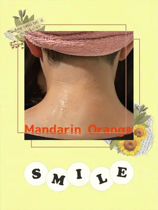 Mandarin Orange所属・毛穴から始める肌メン テマンダリンオレンジのエステ・リラクイメージ