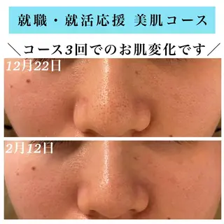 Bellesthe （ベルエステ）のエステ・リラクイメージ