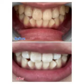 M渋谷店所属・Ｍ渋谷 ホワイトニングのエステ・リラクイメージ