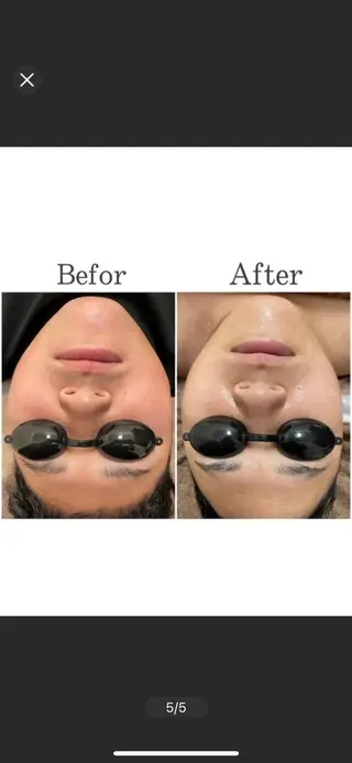 【folche】 フジイのエステ・リラクイメージ