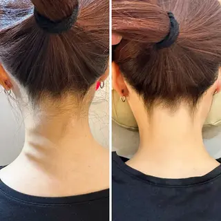 うなじ脱毛/美肌脱毛 LABELのエステ・リラクイメージ