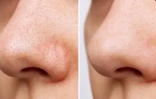 高田馬場店 /ゆづのヘアスタイル