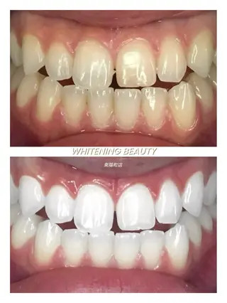 ホワイトニングビューティー東陽町店所属・ホワイトニング ビューティー東陽町店のその他イメージ