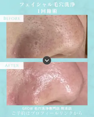 韓国式フェイシャル エステGROW熊本店のエステ・リラクイメージ