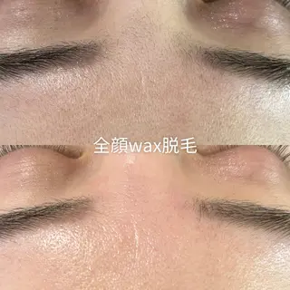 EST BEAUTY所属・顔ワックス脱毛/ ハーブピーリングのエステ・リラクイメージ