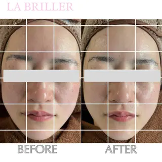 LA BRILLERのエステ・リラクイメージ