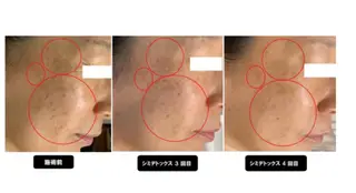 ヴィーナス ビューティーのエステ・リラクイメージ