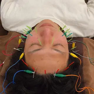 美容鍼灸整体サロンBeauJu所属・小顔矯/美容鍼/鍼灸 BeauJuのその他イメージ