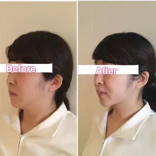 美容鍼・整体サロン アネモネ🌸心斎橋のエステ・リラクイメージ