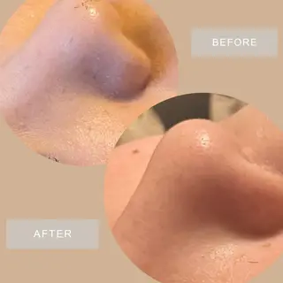 NATURA所属・シェービングサロン NATURAのエステ・リラクイメージ