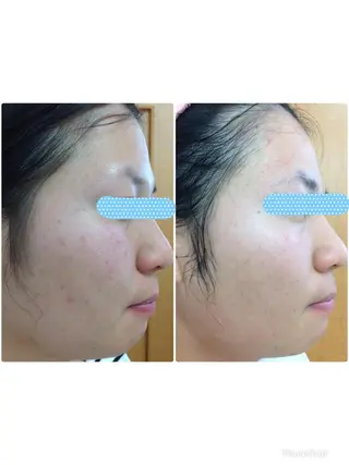 Facial stylist salon伊勢崎所属・中島 有希のエステ・リラクイメージ