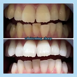 ホワイトニング ショップ千葉店のその他イメージ