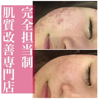 ミディアム カラー パーマ ヘアアレンジ メンズ キッズ ネイル マツエク・マツパ アイブロウ ニキビ・肌質改善専門 ♡人生が変わるサロンのエステ・リラクイメージ