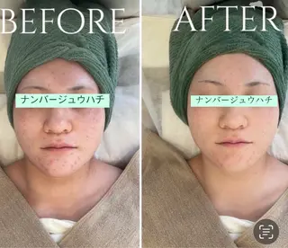 韓国肌管理ララピール 小顔リフト/LDMのエステ・リラクイメージ