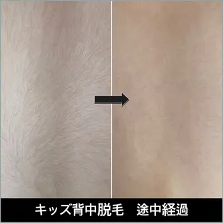 キッズ LUNARIA 〜ルナリア〜のエステ・リラクイメージ