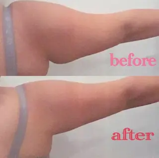 HappIness 遠赤外線ドームのエステ・リラクイメージ