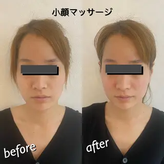 うなじ脱毛/美肌脱毛 LABELのエステ・リラクイメージ