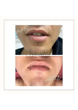 メンズ 脱毛/美肌【皮膚科看 護師経営】ラベニールのエステ・リラクイメージ