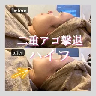 第一印象専門サロン ADISEのエステ・リラクイメージ