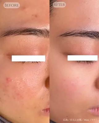 Mau beauty salon所属・Mau (マウ)のエステ・リラクイメージ