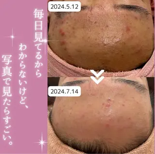 【現役看護師】高来 笑子のエステ・リラクイメージ