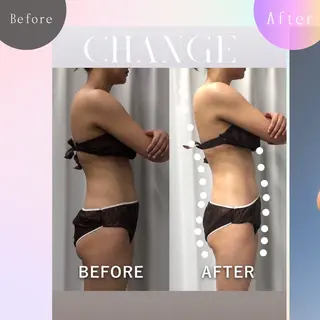 美容整体・塗る漢方・フェイシャルRechica所属・心斎橋痩身 美肌整体サロン💓のエステ・リラクイメージ