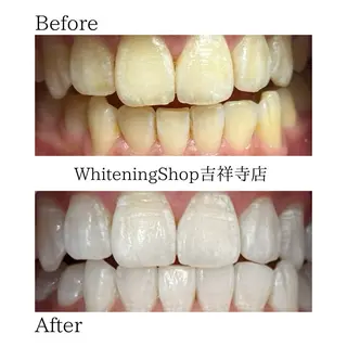 ホワイトニング ショップ吉祥寺店のエステ・リラクイメージ