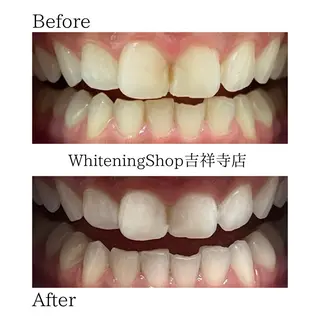 ホワイトニング ショップ吉祥寺店のエステ・リラクイメージ