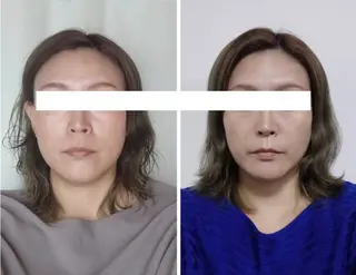 丸顔さんの救世主 高田 くみのエステ・リラクイメージ