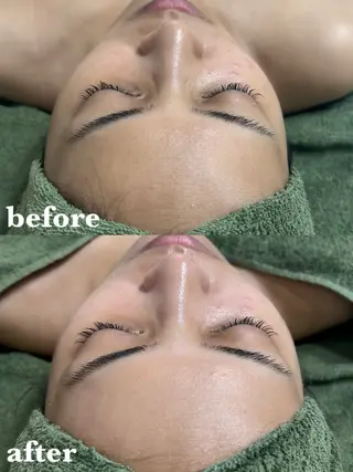 【肌質改善サロン】 リーフィアのエステ・リラクイメージ