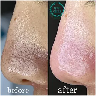 枝廣 貴子のエステ・リラクイメージ