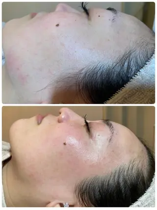 Le cherien所属・Le cherien ルシェリアのエステ・リラクイメージ