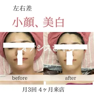 オアシス・さくら所属・小顔（シミ ニキビ）脱毛サロンのエステ・リラクイメージ