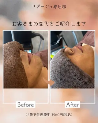 春日部 リダージュのエステ・リラクイメージ