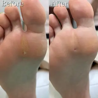 ネイル 東京巻き爪アカデミー所属・東京巻き爪 アカデミーのエステ・リラクイメージ