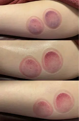 a  room salonのエステ・リラクイメージ