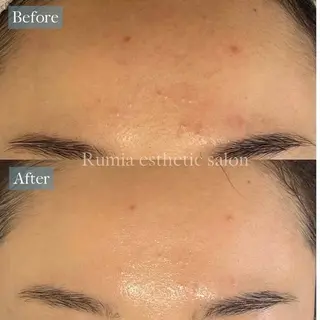 Rumia Salonのエステ・リラクイメージ