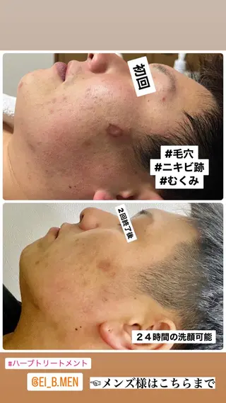 ダイエット／脱毛 美顔／フォト／ハーブのその他イメージ