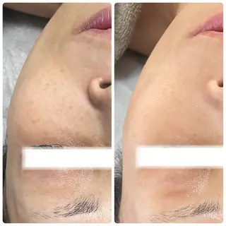 Esthe salon Blanche(エステサロンブランシュ)所属・小顔リフトアップ 美肌改善専門店のエステ・リラクイメージ