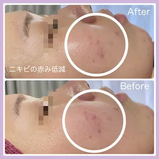 【代謝×免疫UP】お肌と身体のオールハンド専門店estheya sign所属・オールハンド専門店 【リンパ×ヘッド】のエステ・リラクイメージ