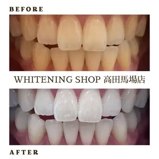 メンズ ホワイトニング ショップ高田馬場店のその他イメージ