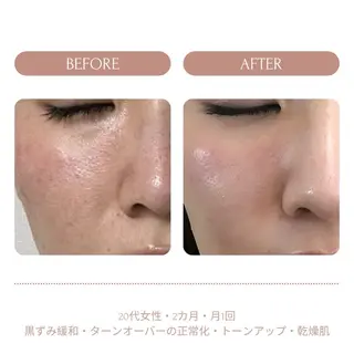 脱毛　Beauty salon Lumiere（ルミエール）所属・完全都度払い脱毛⭐︎ Lumiereのエステ・リラクイメージ