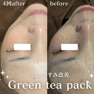 美肌salon GRAN CUORE所属・Natsuki🌙 GRAN CUOREのエステ・リラクイメージ